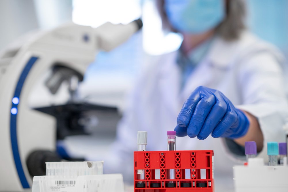 lab tests at home doha qatar